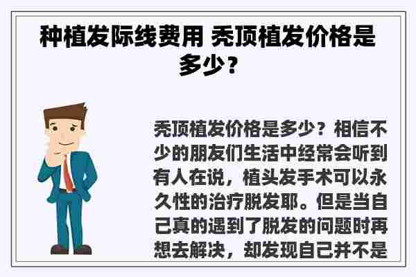 种植发际线费用 秃顶植发价格是多少？